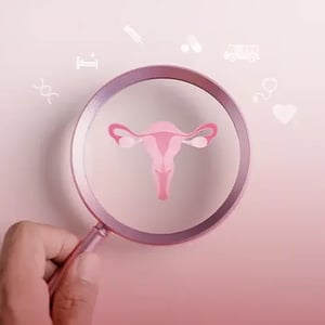 Fem-Care-virus-Virus-de-Papiloma- Humano