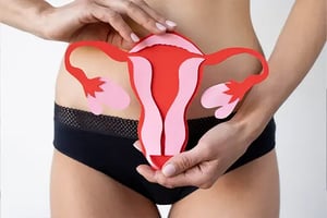 Irregularidad-Menstrual-causada-por-el-Sindrome-de-Ovario-Poliquistico