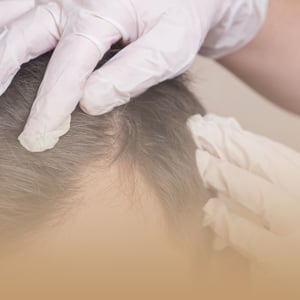 bloque-box-dermatologia-medica-de-cabello