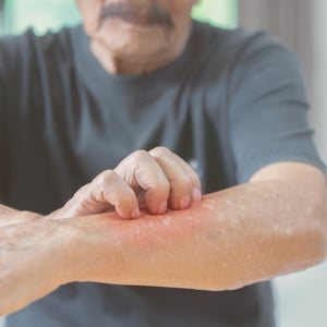 box-imagen-dematitis
