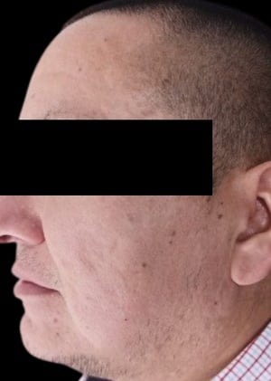 despues-de-2-sesiones-v3